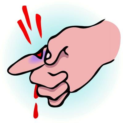 New research shows that this common workplace injury is now very rare. What is it? New research shows that this common workplace injury is now very rare. What is it?